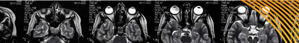 X-RAYS