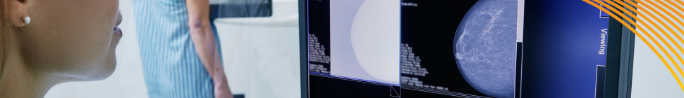 Doctor looking at Mammogram